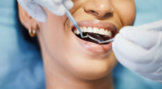 Best Chipped Tooth Repair Near Me  in Nissequogue, NY