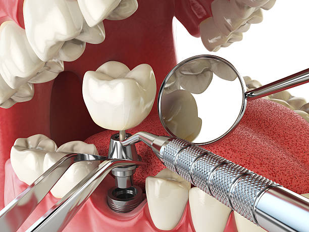 Best Knocked-Out Tooth Emergency  in Nissequogue, NY